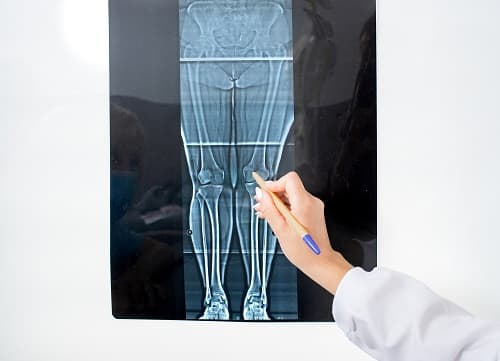 Lower Limb Anatomy