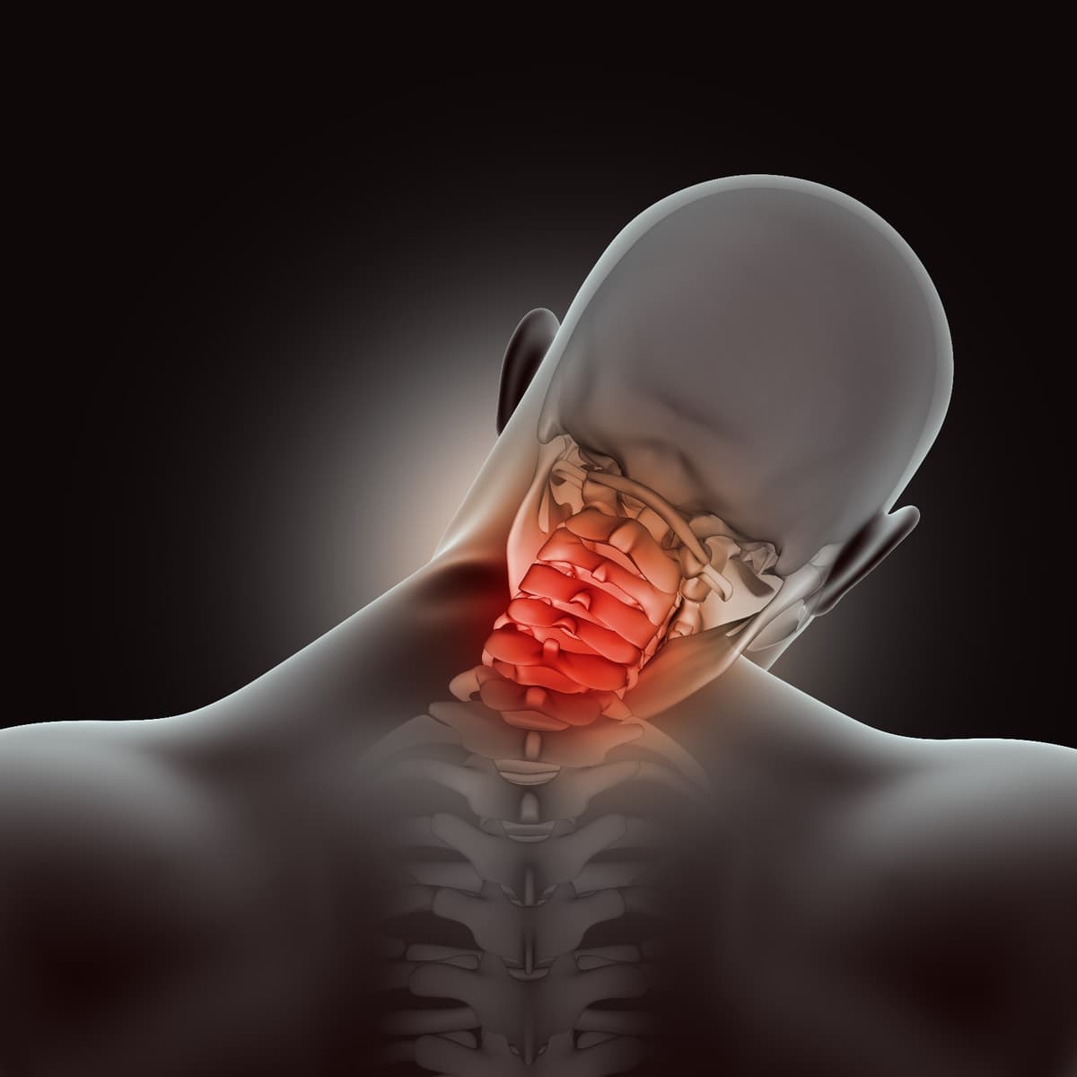 neck pain causes|cervical spondylosis| सर्वाइकल पेन